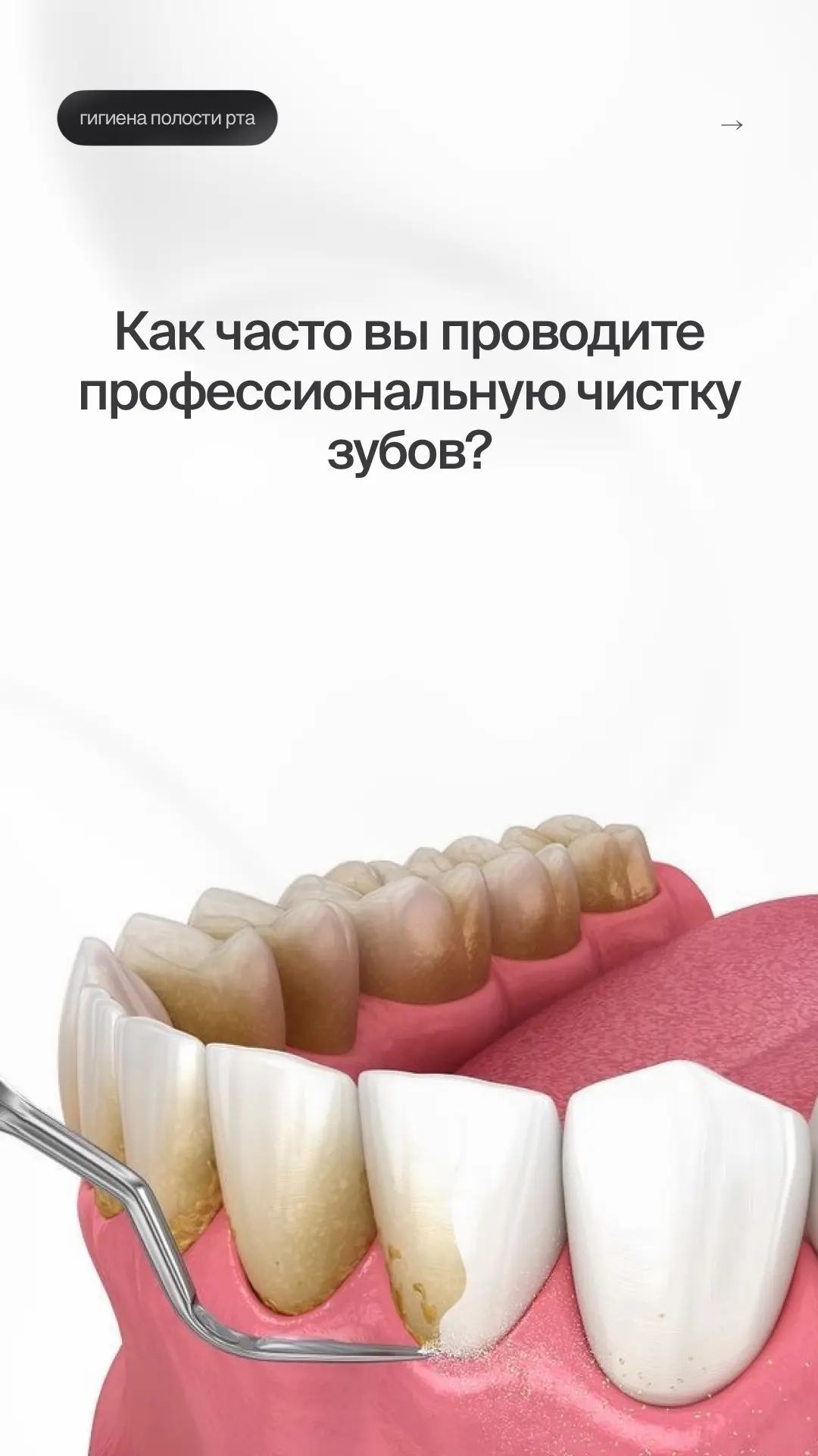 📌 ПРОФЕССИОНАЛЬНАЯ ГИГИЕНА ПОЛОСТИ РТА