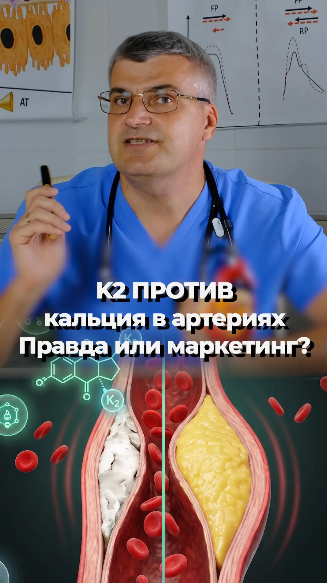K2 снижает кальций в артериях — но так ли это хорошо, как кажется? Разбираю парадокс: п...