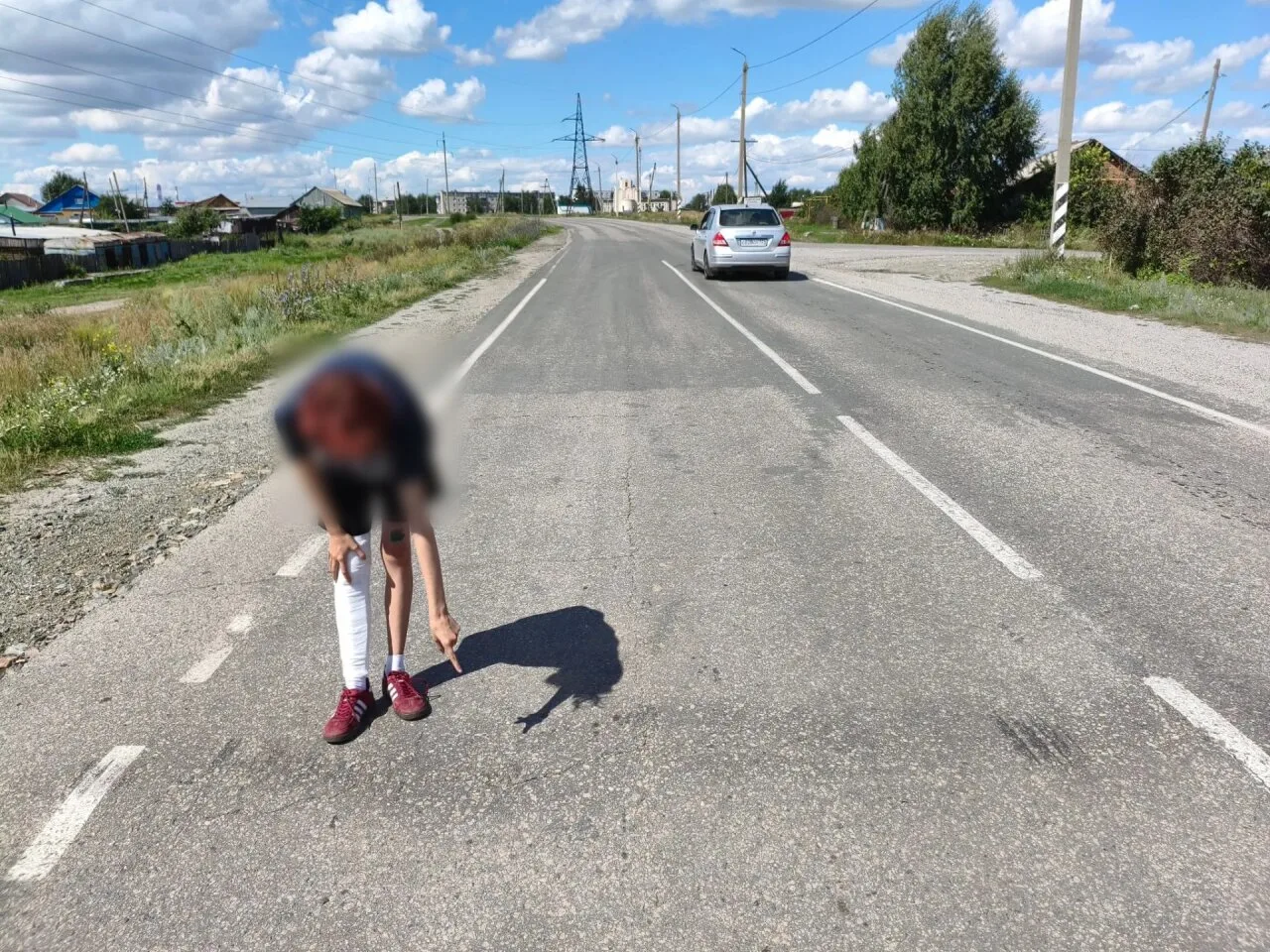 В Троицком округе девочка упала с самоката и получила травму.