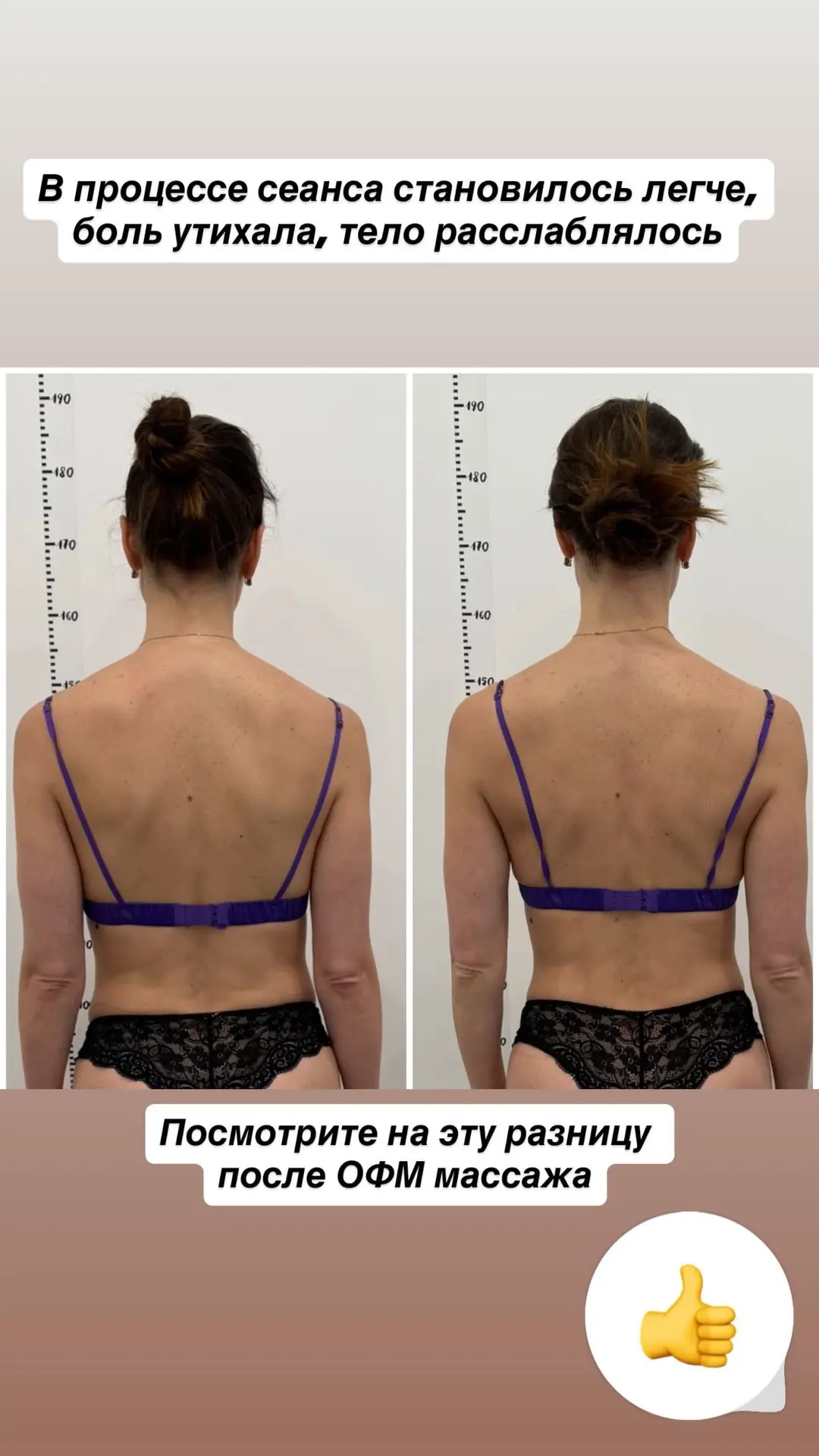 Со слезами мы спасали Юлю с помощью остео-фейсфитнес массажа.