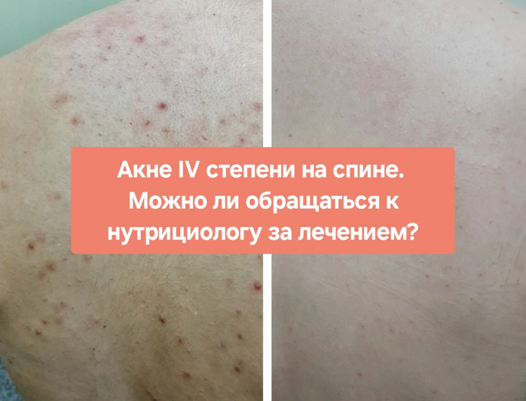 Меня всегда удивляет, когда врач берется лечить пациента не по клиническим рекомендация...