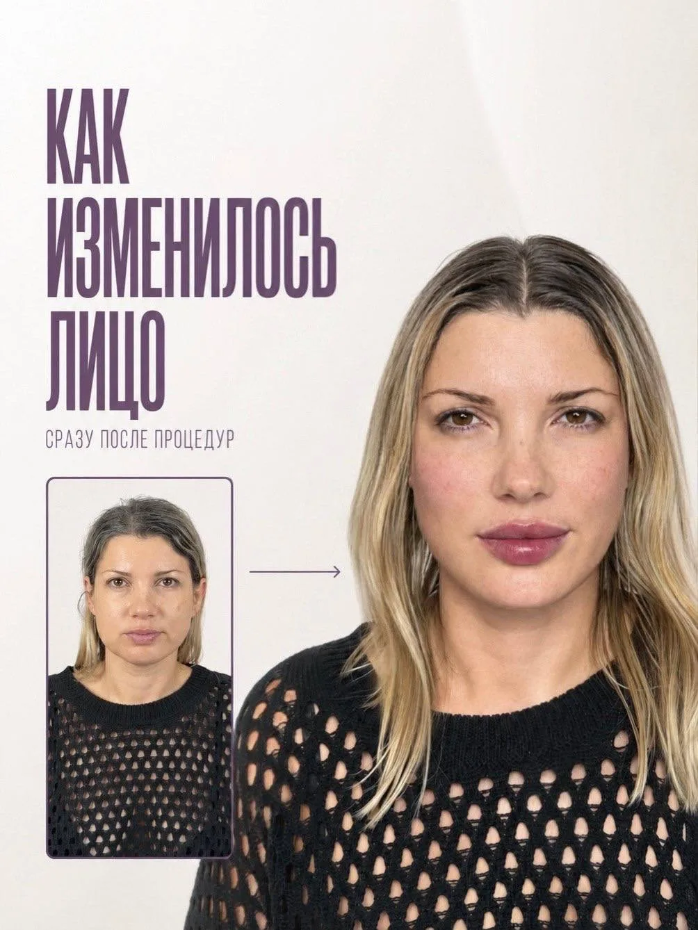 Мечтала об этом год… Не пожалела 🤍