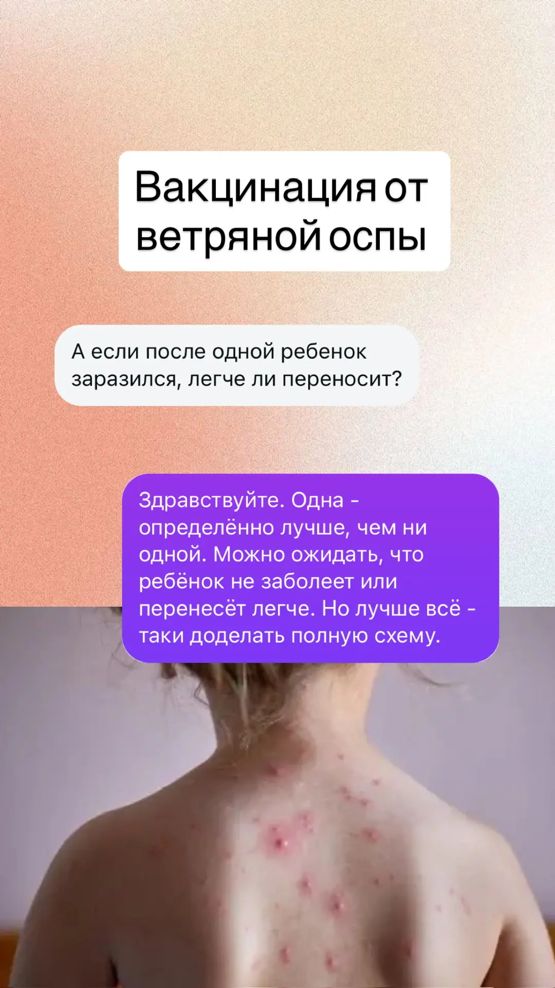- нужно ли делать прививку от ветряной оспы, если есть антитела - нужна ли ревакцинация от ветряной 