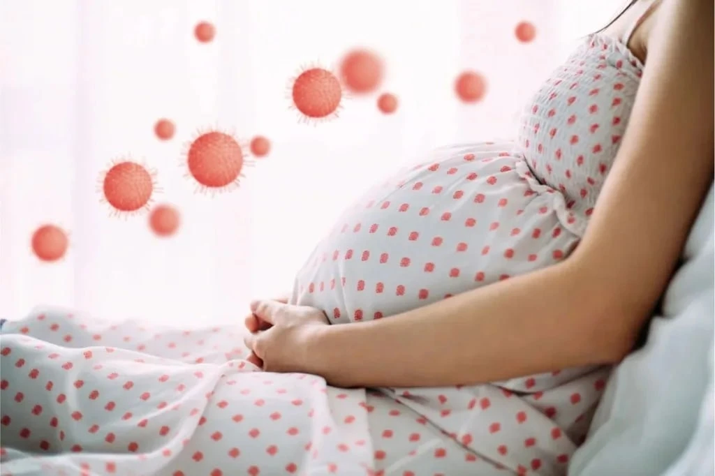 🤰 Ветрянка и беременность: что нужно знать каждой будущей маме?