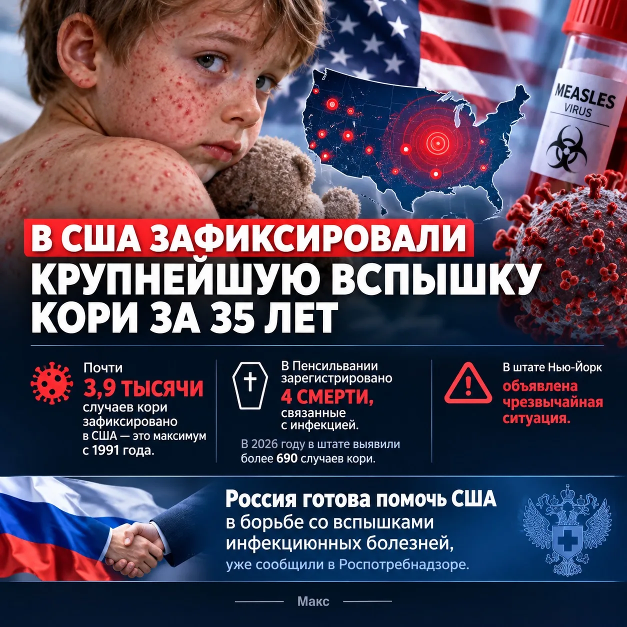 🚨 США столкнулись с крупнейшей вспышкой кори за 35 лет