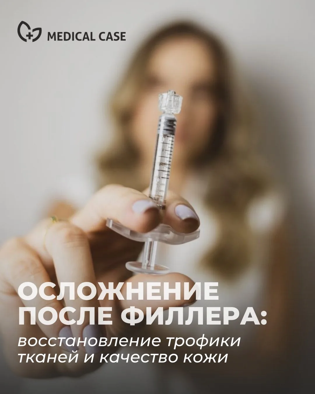Осложнение после филлера: как удалось восстановить трофику тканей и качество кожи