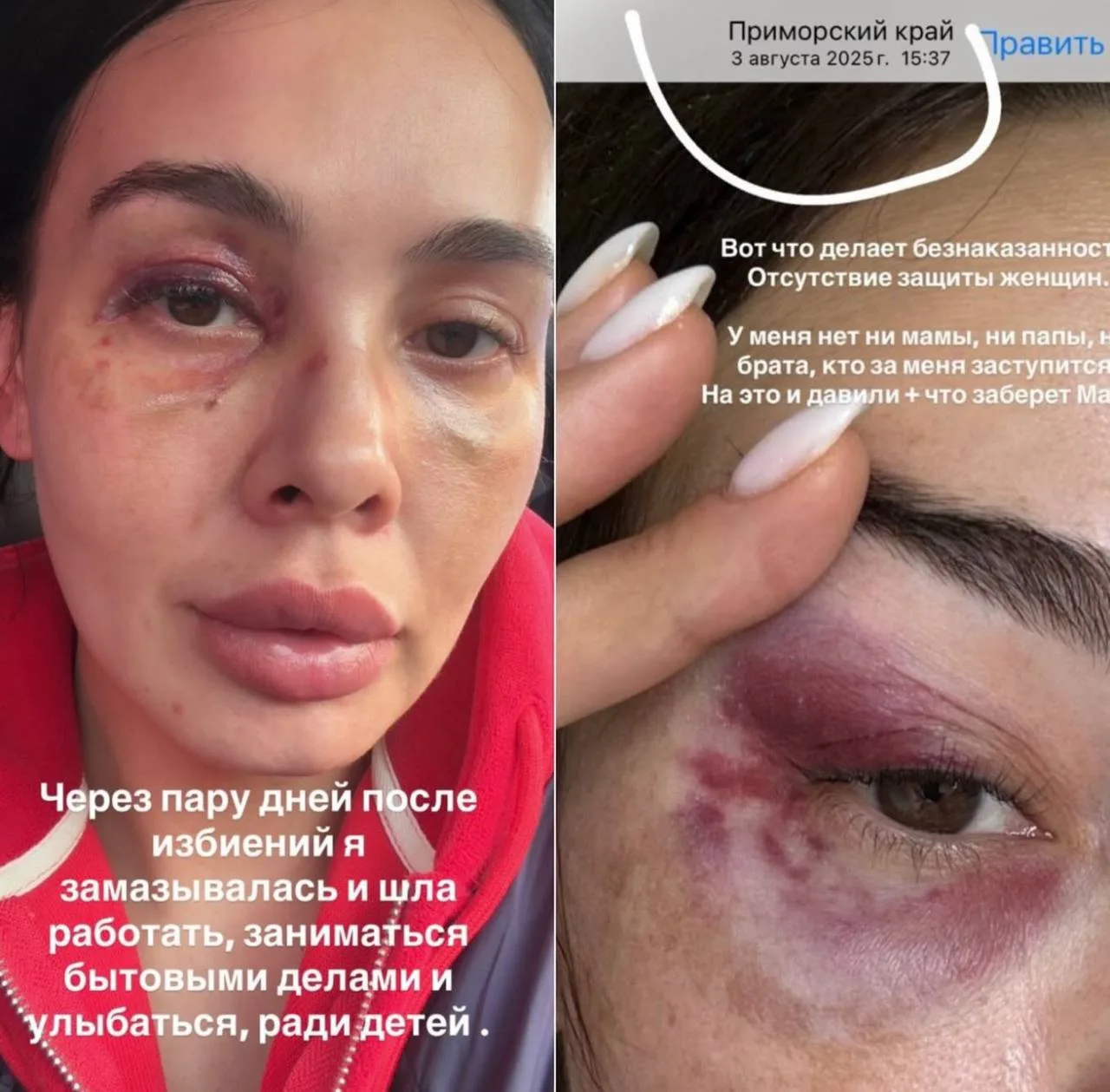 Прокуратура Советского района Владивостока утвердила обвинительное заключение 31-летнем...