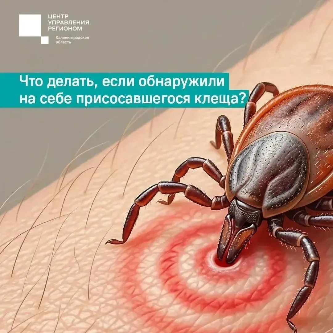 В сезон клещей важно знать: