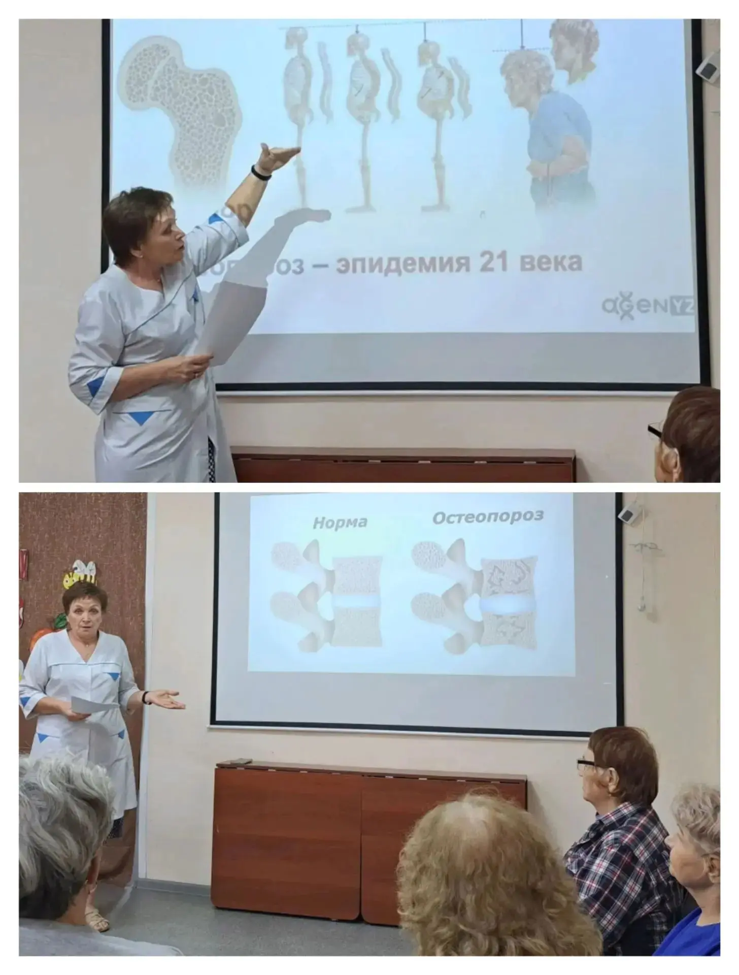 Для остеопороза не характерны явные клинические признаки до момента травмы, он проявляе...