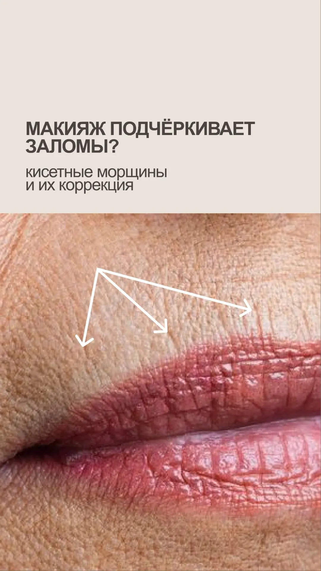 Макияж подчёркивает заломы? КИСЕТНЫЕ МОРЩИНЫ И ИХ КОРРЕКЦИЯ

Когда макияж начинает подчёркивать зало