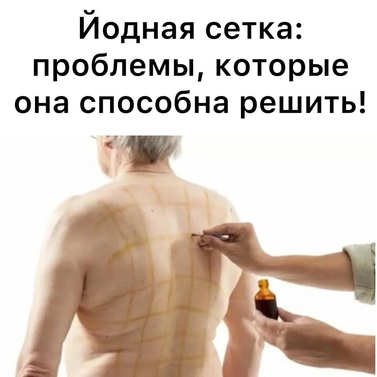 Йодная сетка: проверенный способ справиться с проблемами