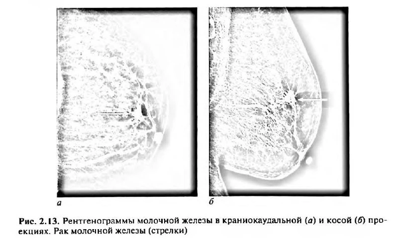 знакомьтесь отечественный учебник по рентгенологии vs зарубежный учебник.