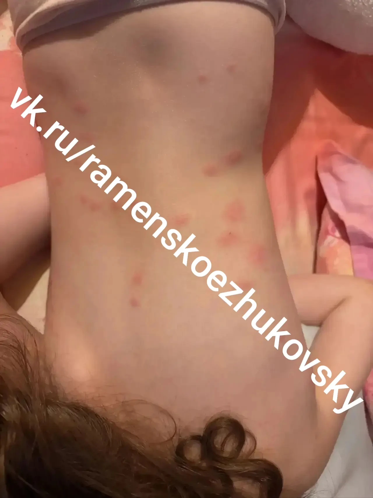 🐜 В детском саду в Раменском обнаружили большое количество блох