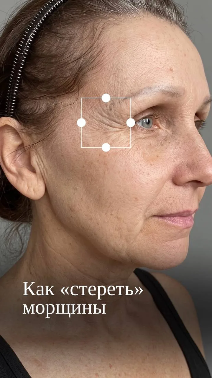 Как стереть морщины?| Даниленко Василиса Сергеевна