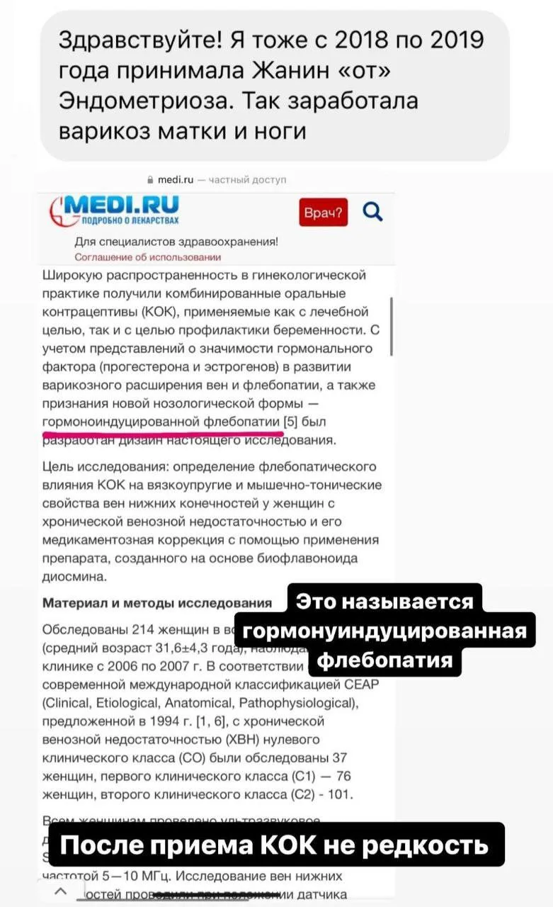 О чем я ранее говорила, что прием гормонов может спровоцировать варикоз
