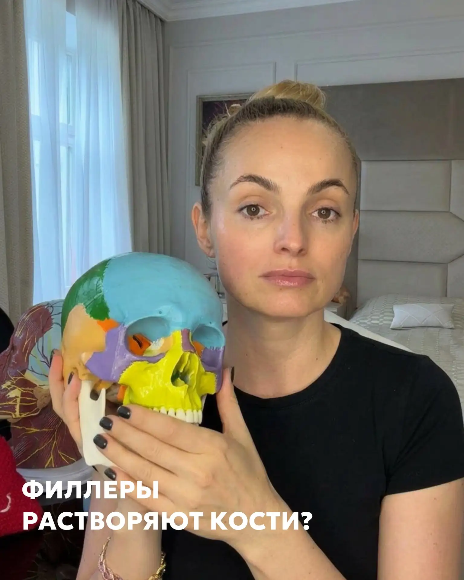 Я на днях столкнулась с исследованием, где говорится о том, что «Вмятины» в черепе посл...
