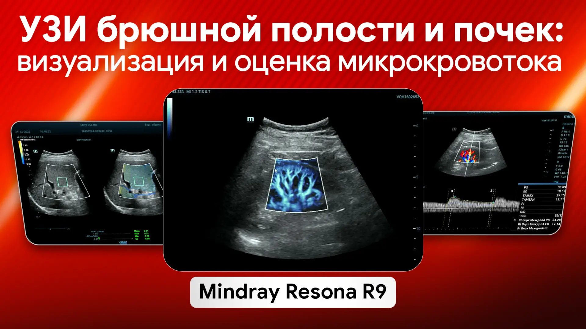⚡️УЗИ брюшной полости и почек: возможности Mindray Resona R9