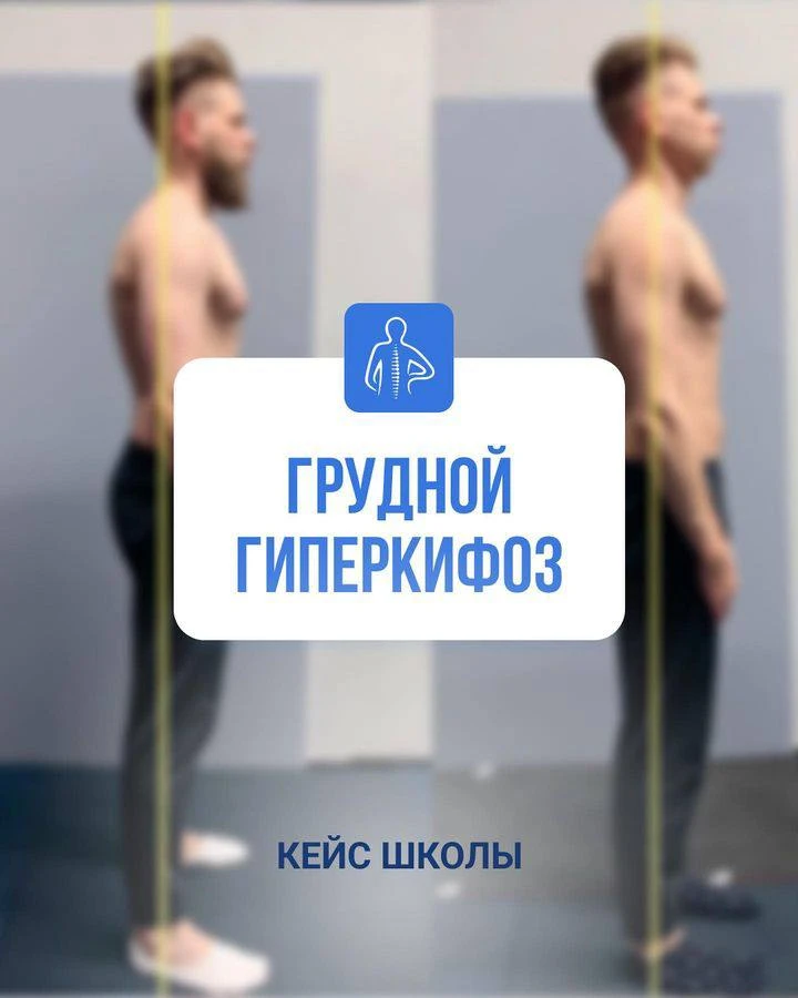 ЗДОРОВАЯ СПИНА — ЗДОРОВОЕ ТЕЛО