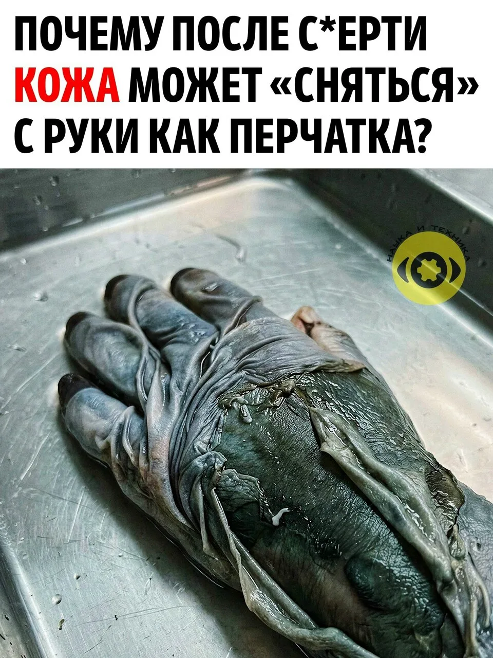 Со временем она может потерять связь с тканями под ней и начать отделяться целыми участ...