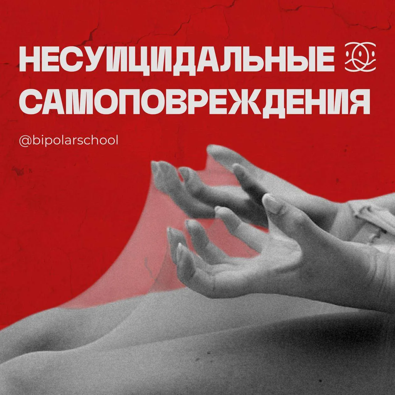 Несуицидальные самоповреждения при биполярном расстройстве