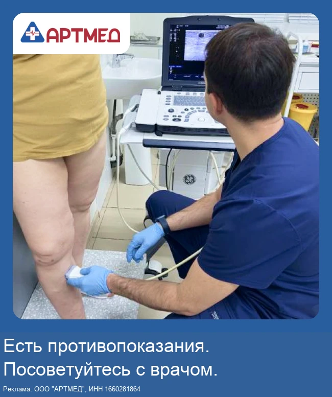 Лечение варикоза в Казани без операции за 1 день