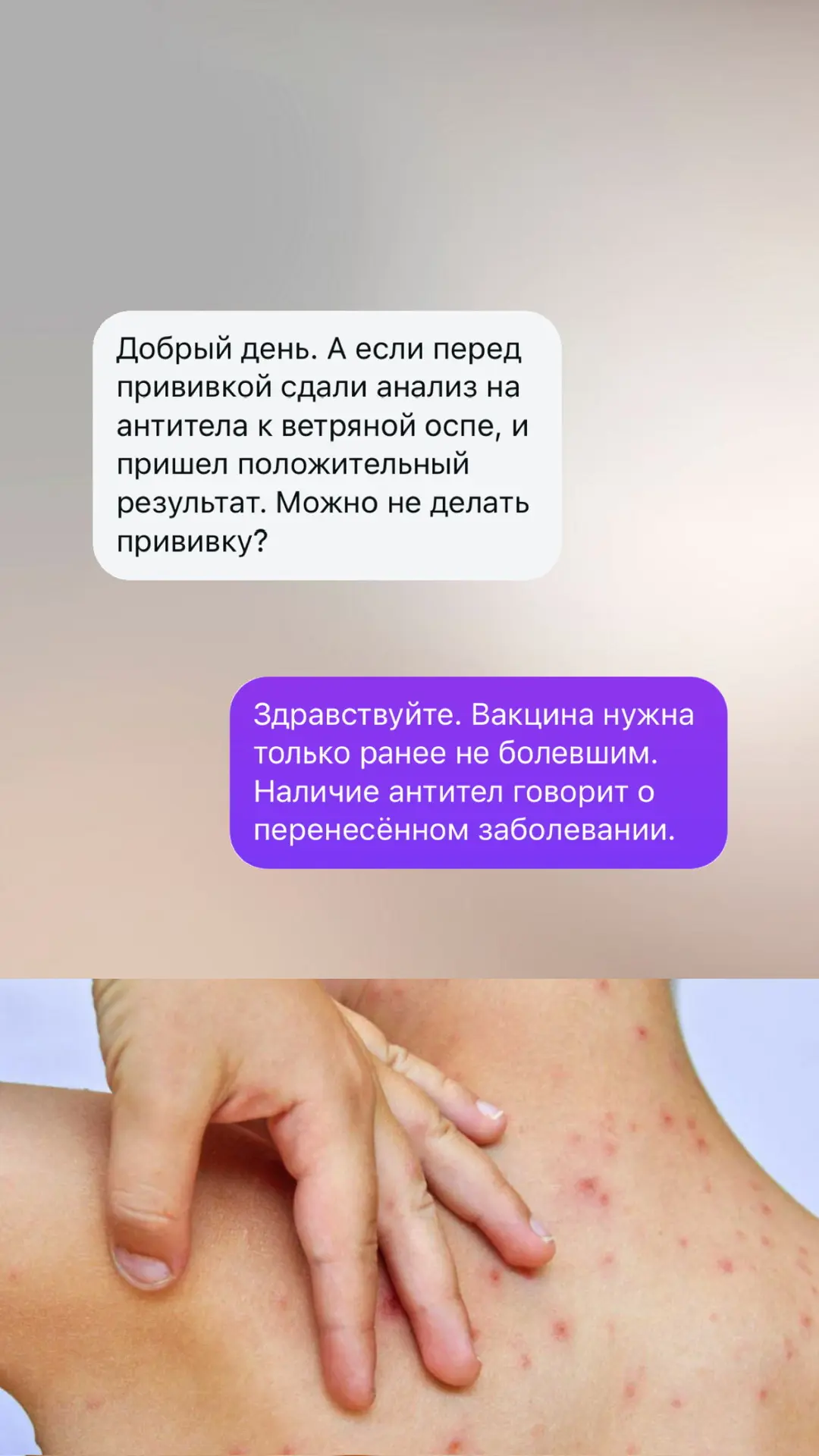 - нужно ли делать прививку от ветряной оспы, если есть антитела - нужна ли ревакцинация от ветряной 