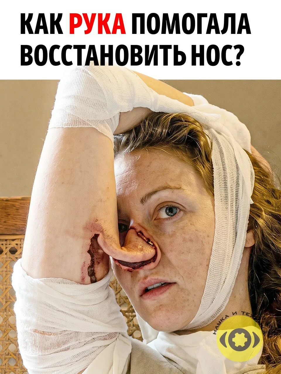 На фотографии показан один из самых необычных принципов пластической хирургии: нос восс...