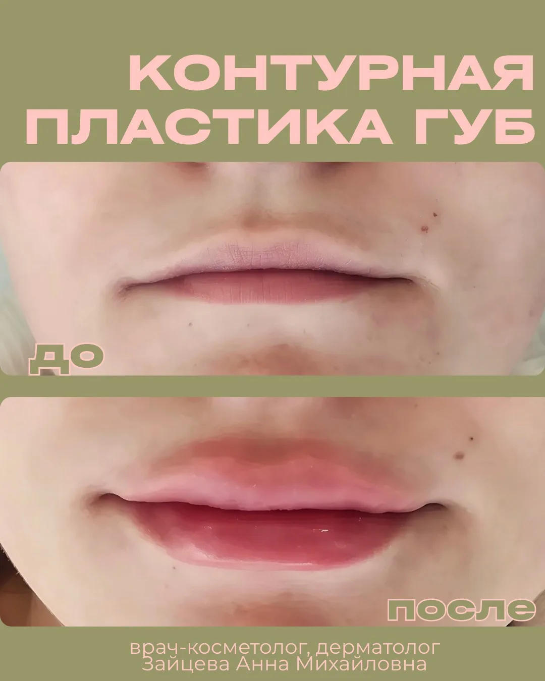 Мгновенное преображение💋