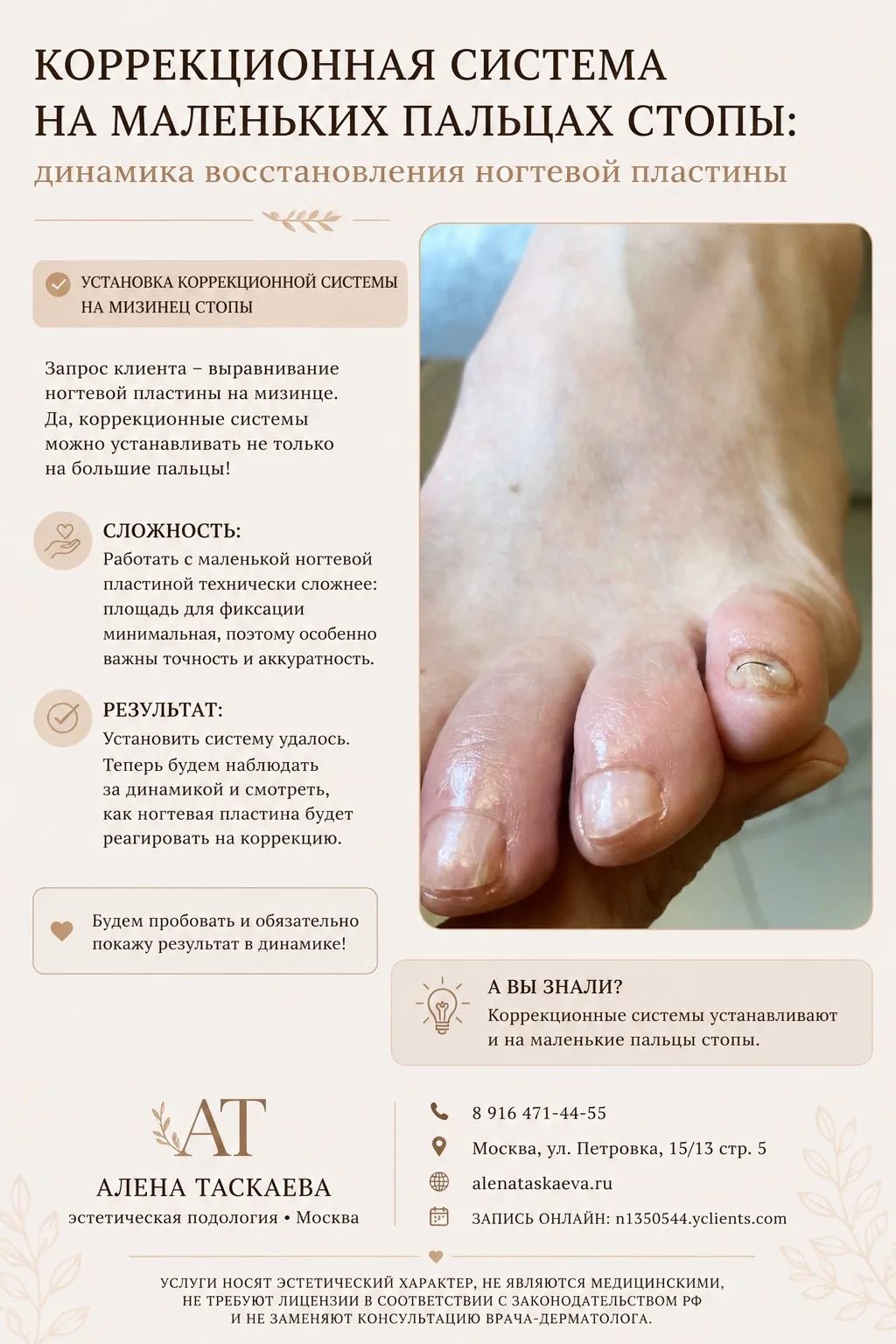 Коррекционная система на маленьких пальцах стопы 👣