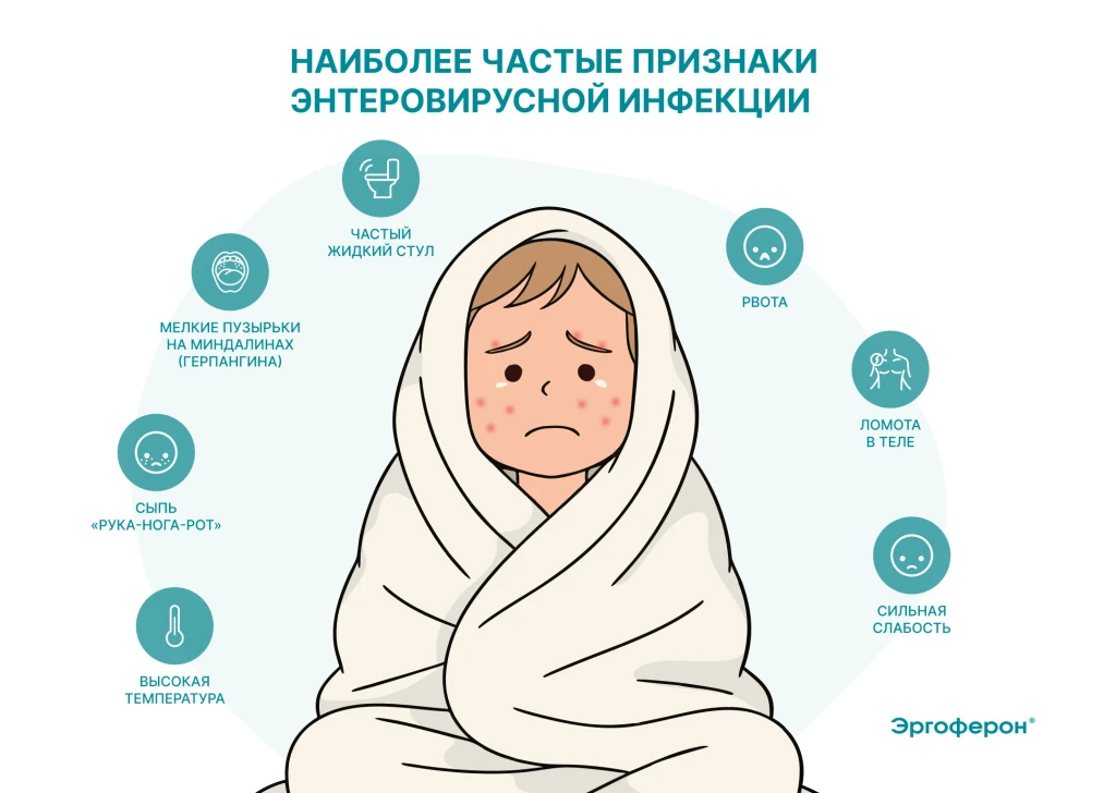 ☀️ Лето, солнце и… энтеровирус: как защитить ребенка в сезон каникул

Лето — долгожданная пора отпус