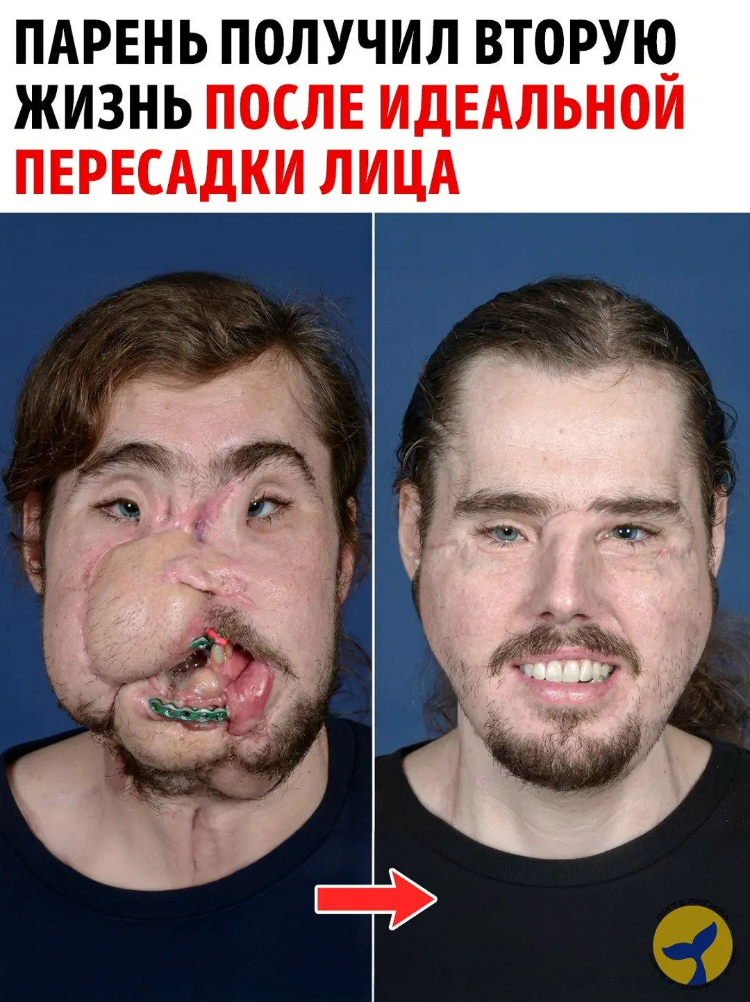 В 2016 году жизнь молодого американца Кэмерона Андервуда навсегда изменилась после глуб...