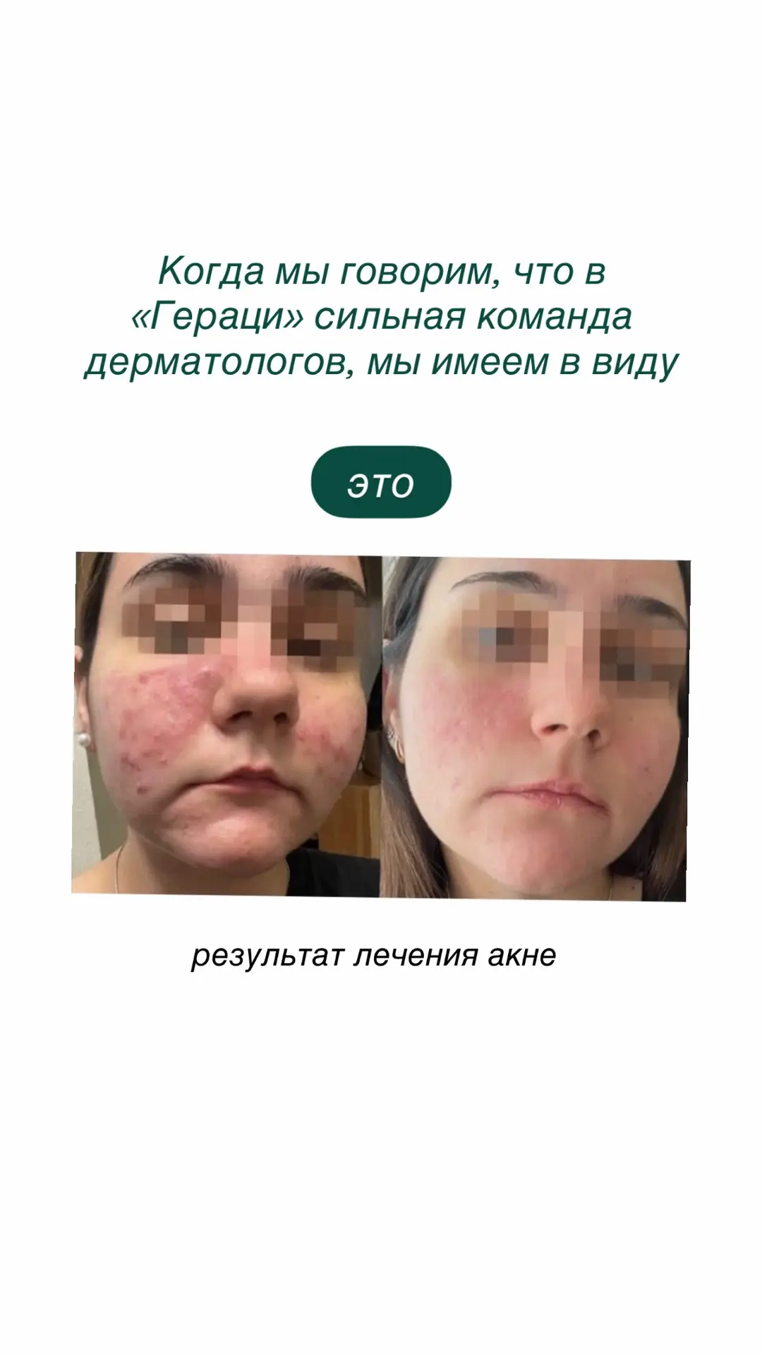 Когда мы говорим, что в «Гераци» сильная команда дерматологов, мы имеем в виду это⬆️