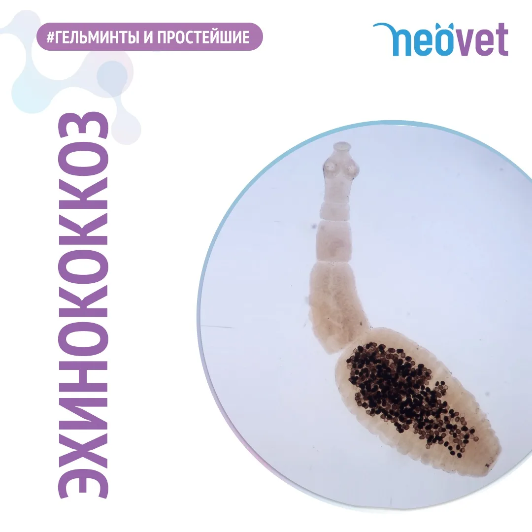 #диагностика_инфекций 

📎Узнайте больше про ЭХИНОКОККОЗ!

〰️〰️〰️〰️〰️〰️〰️〰️〰️〰️
Подробнее о заболева