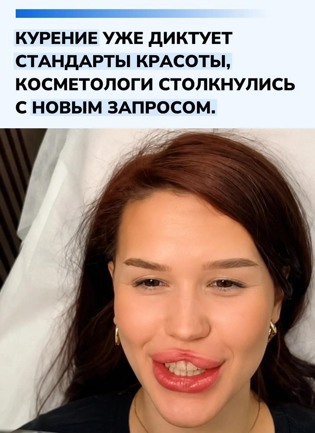 Российские косметологи рассказали о необычном тренде: некоторые клиентки просят изменит...