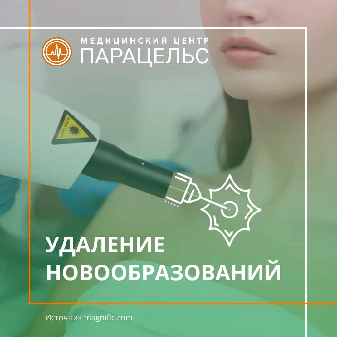 УДАЛЕНИЕ ДОБРОКАЧЕСТВЕННЫХ НОВООБРАЗОВАНИИ КОЖИ