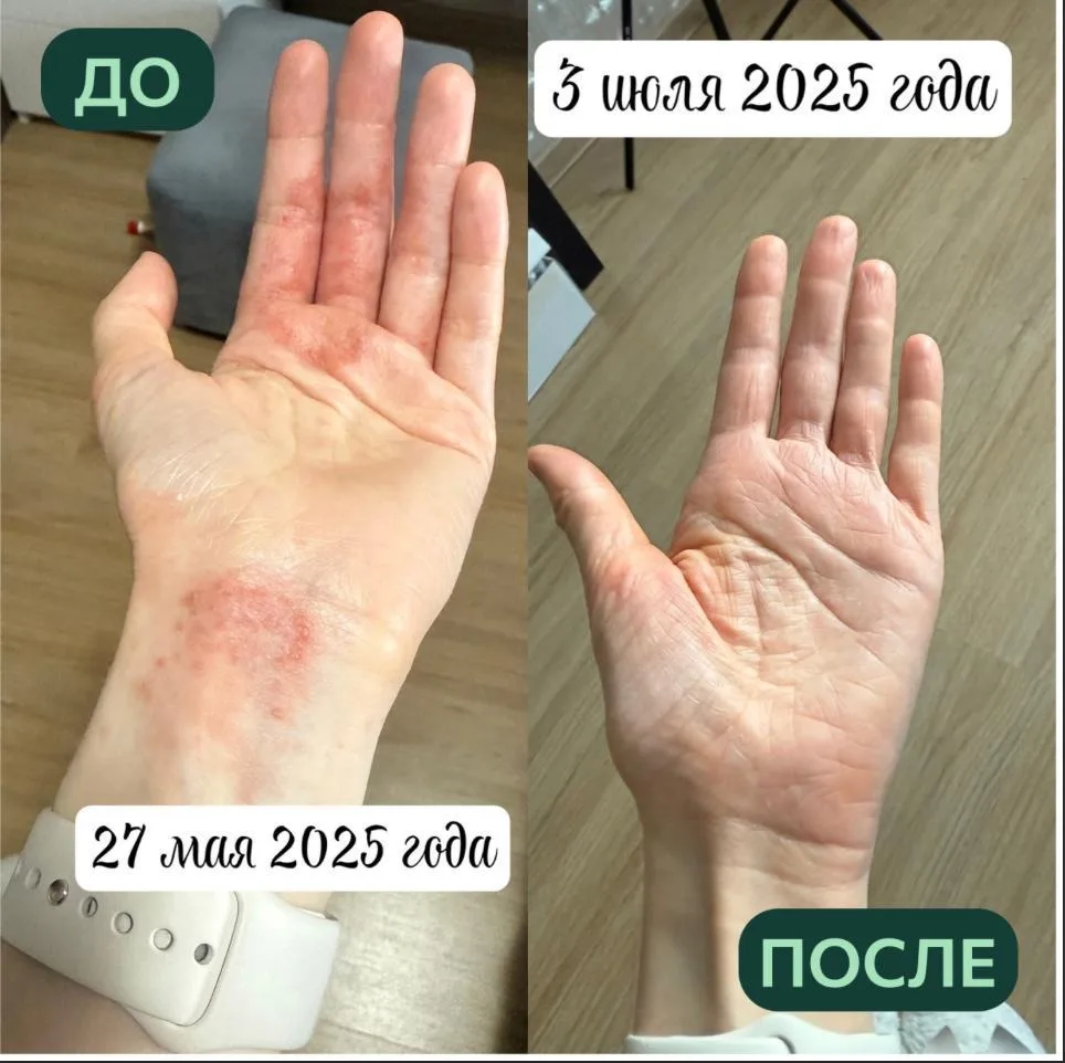 Как убрать воспаление в ЖКТ и не сделать себе хуже   Если вы годами живете со вздутием, тяжестью, пр