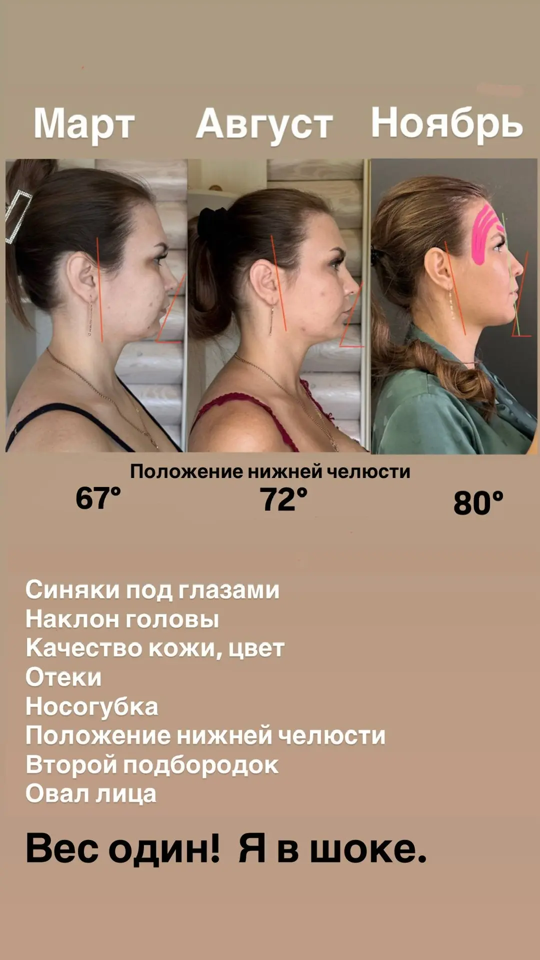 ХОТИТЕ ТОЧЁНЫЕ СКУЛЫ?  А чёткий овал лица без отека и брылей? Делайте вторую часть упражнения, котор