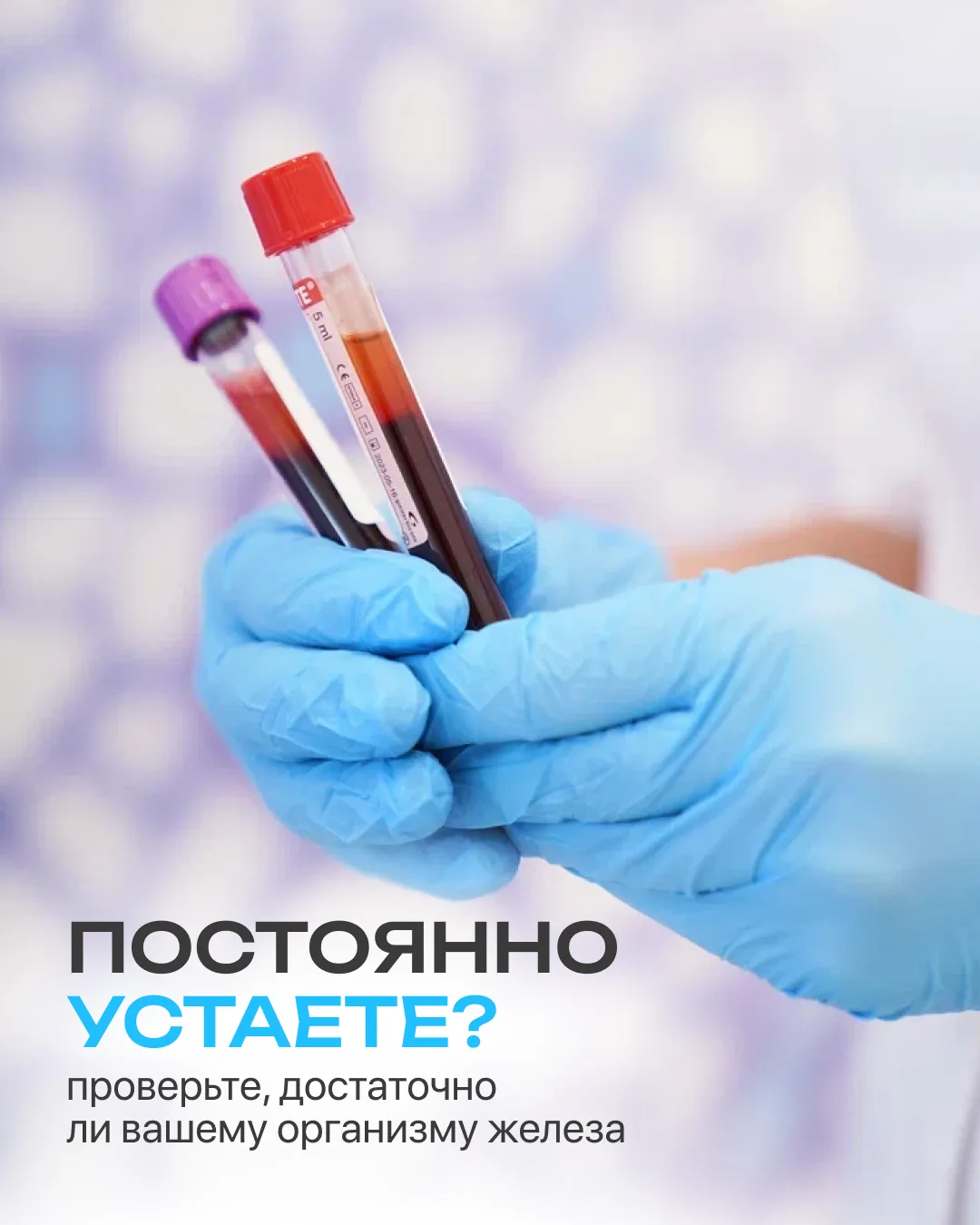 Усталость — это не всегда про недосып