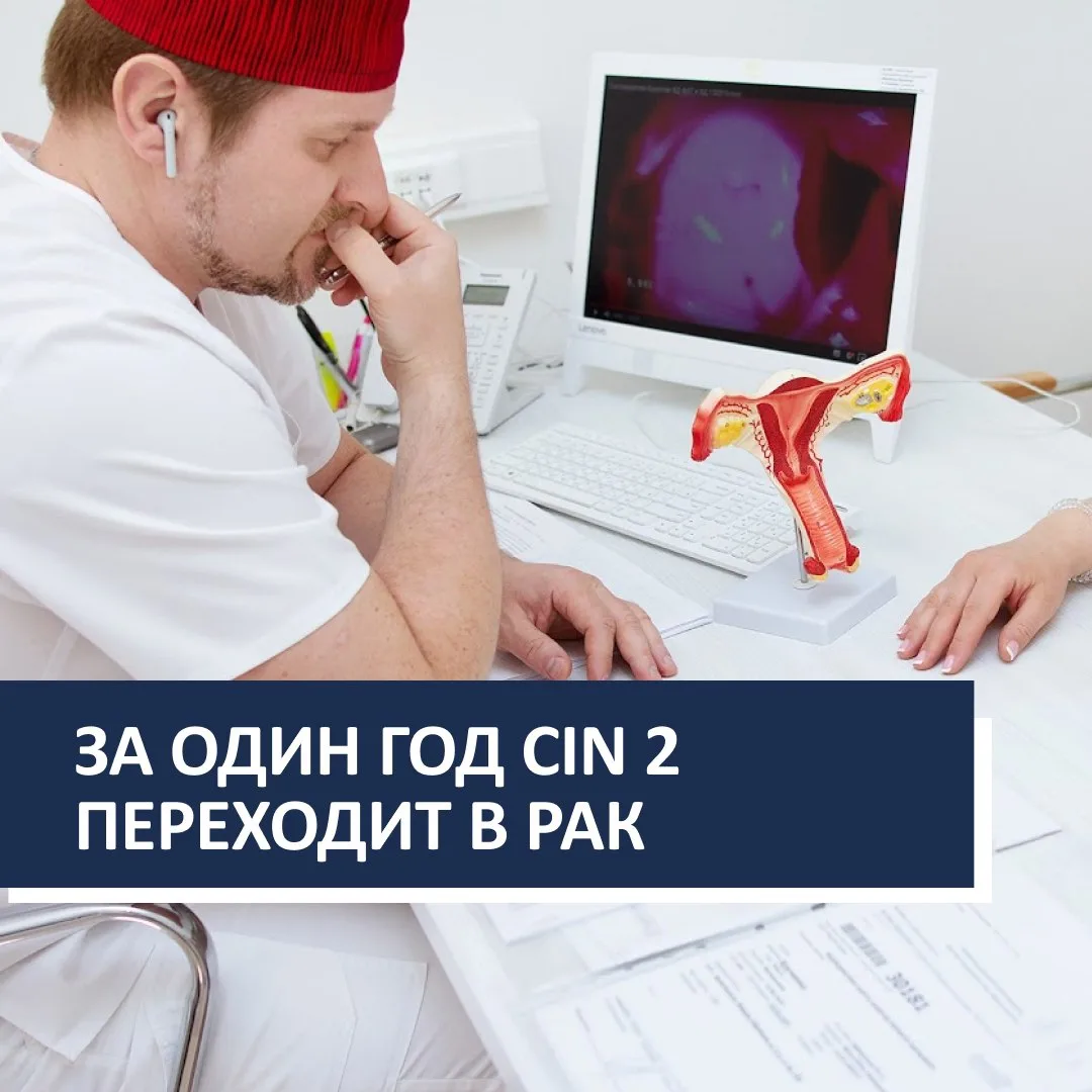 За один год CIN 2 переходит в рак, а врачи теряют время на повторные анализы вместо леч...