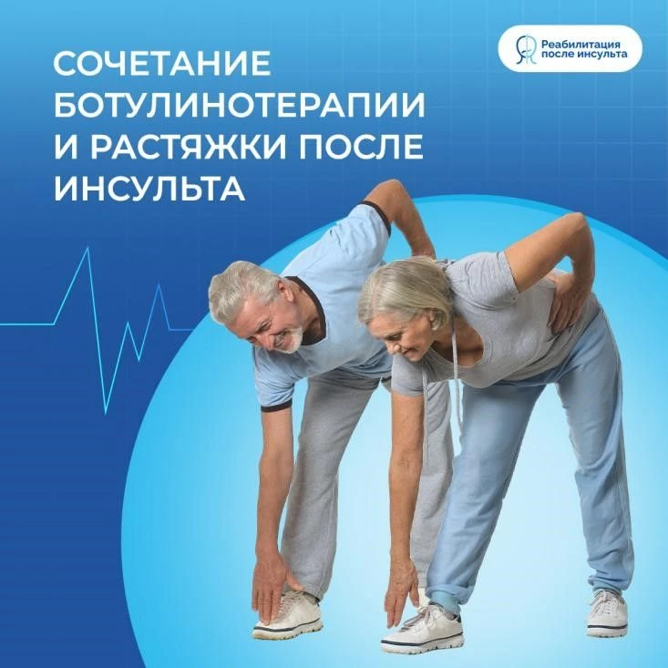 Ботулинотерапия и растяжка после инсульта: результаты исследования сочетания методик