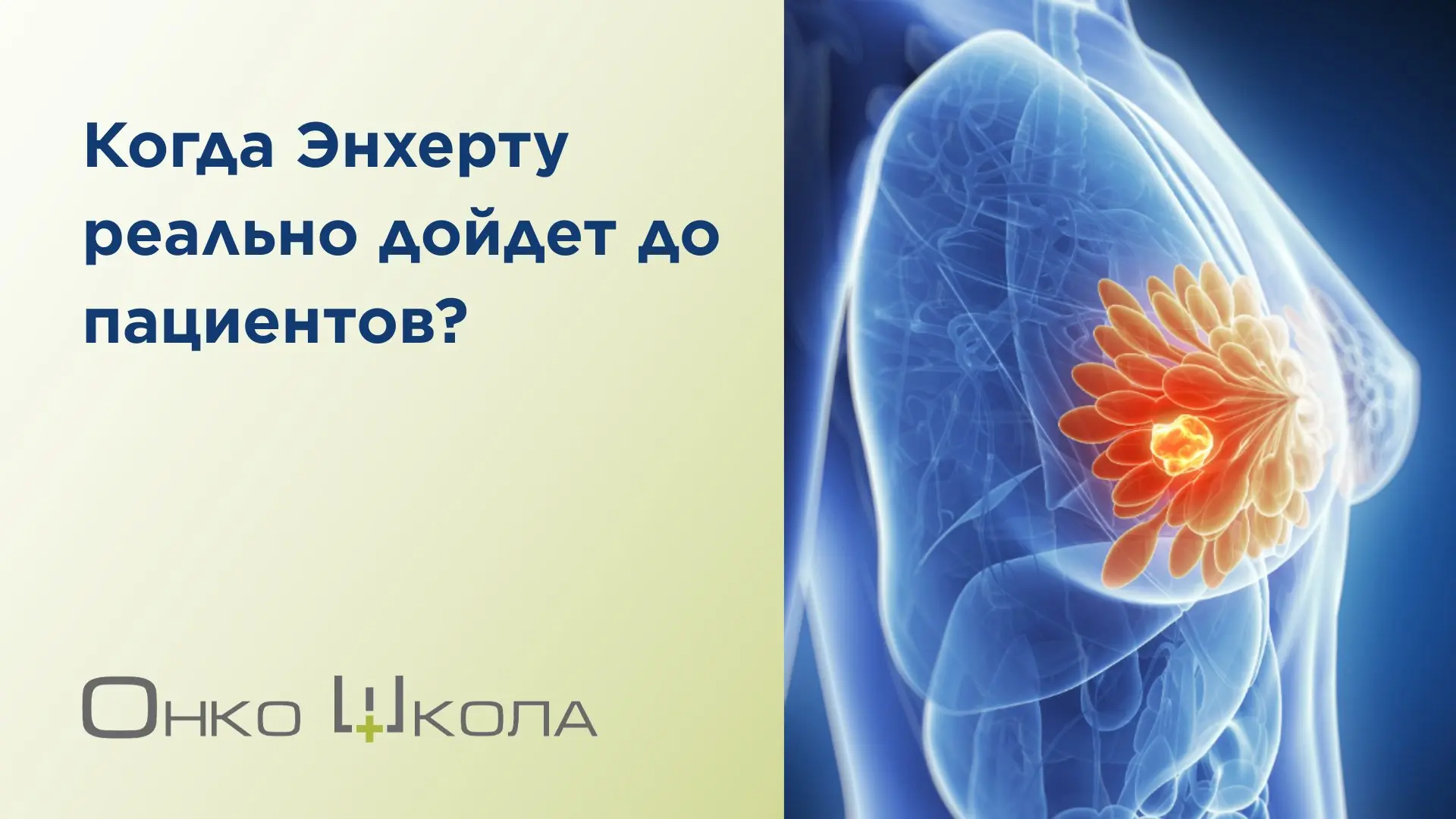 Недавно мы писали радостную новость: комиссия Минздрава рекомендовала включить Энхерту ...