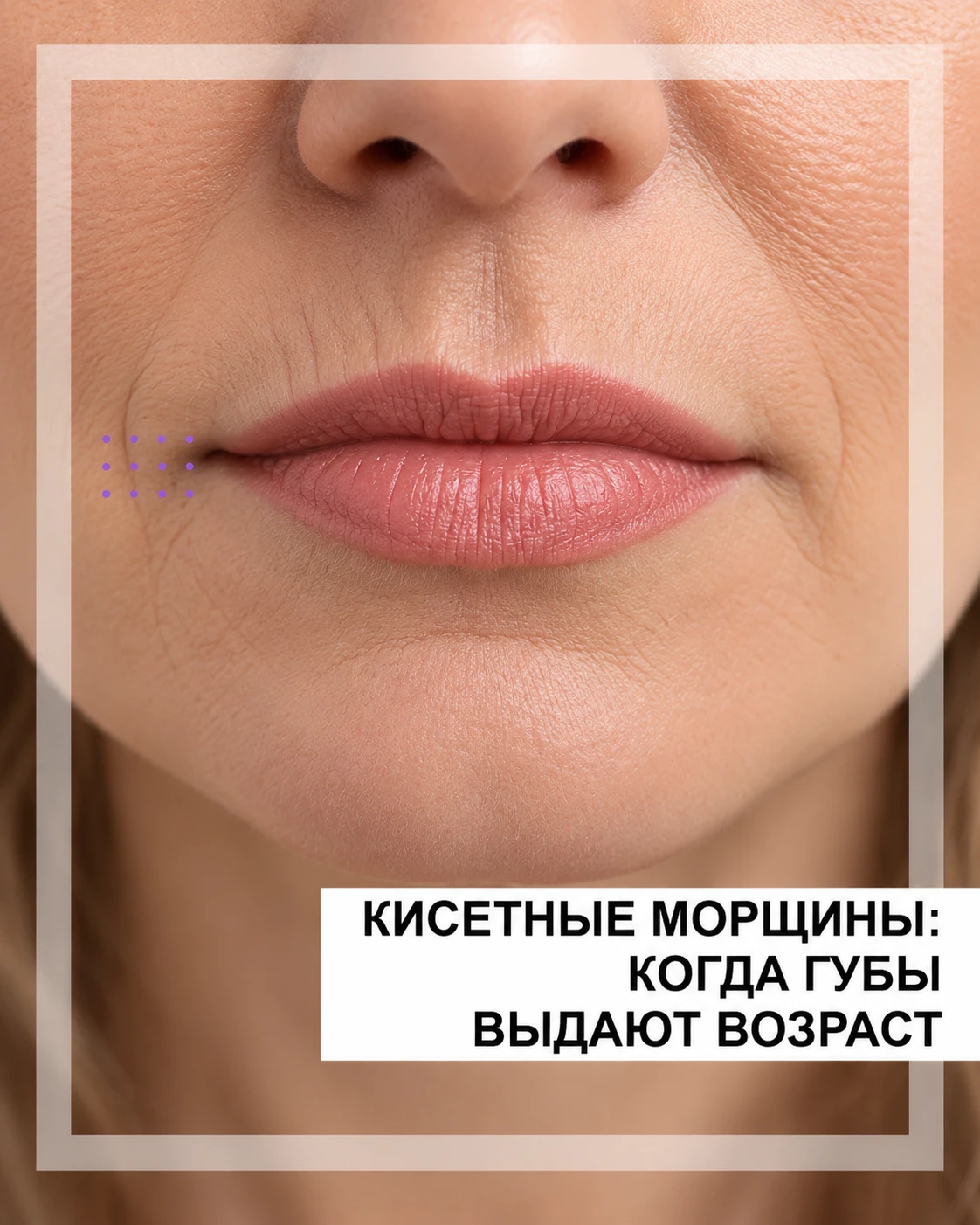👄 Кисетные морщины: когда губы выдают возраст