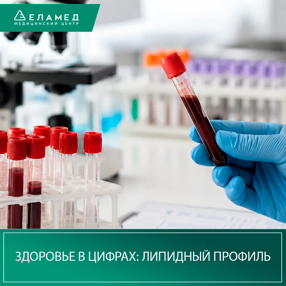 Здоровье в цифрах: липидный профиль 🩸

Высокий холестерин никак не ощущается — ничего не болит, сам