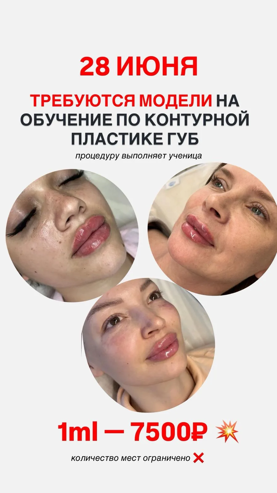 Нужны модели на обучение по контурной пластике губ. 
Работу выполняет ученица (практикующий доктор) 