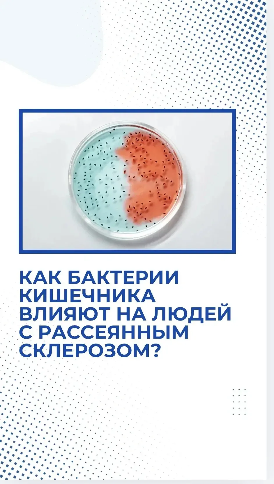 Как бактерии кишечника влияют на людей с рассеянным склерозом?

Кишечник и мозг связаны. У людей с р