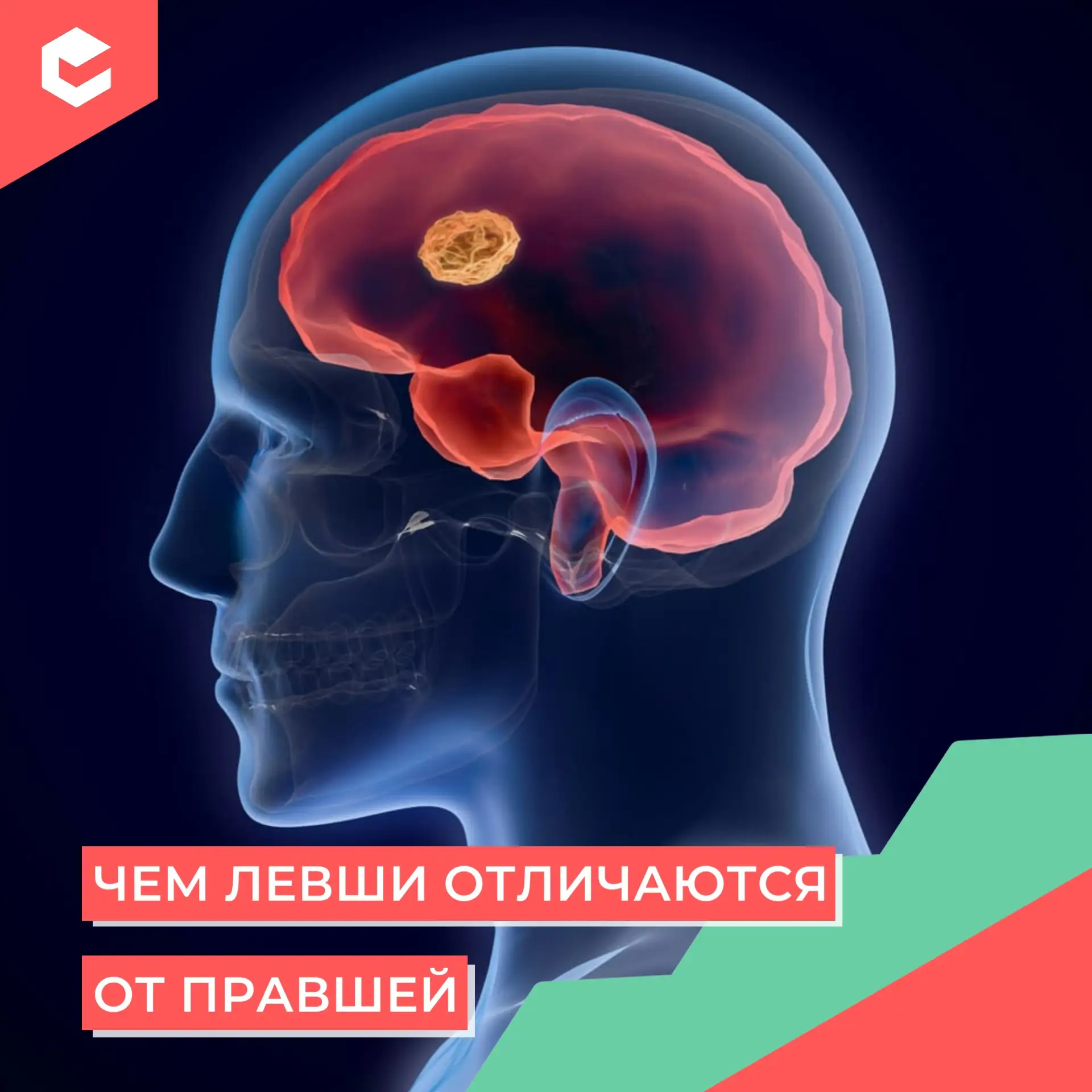 Левши и правши отличаются не только ведущей рукой, но и тем, что их мозг работает немно...