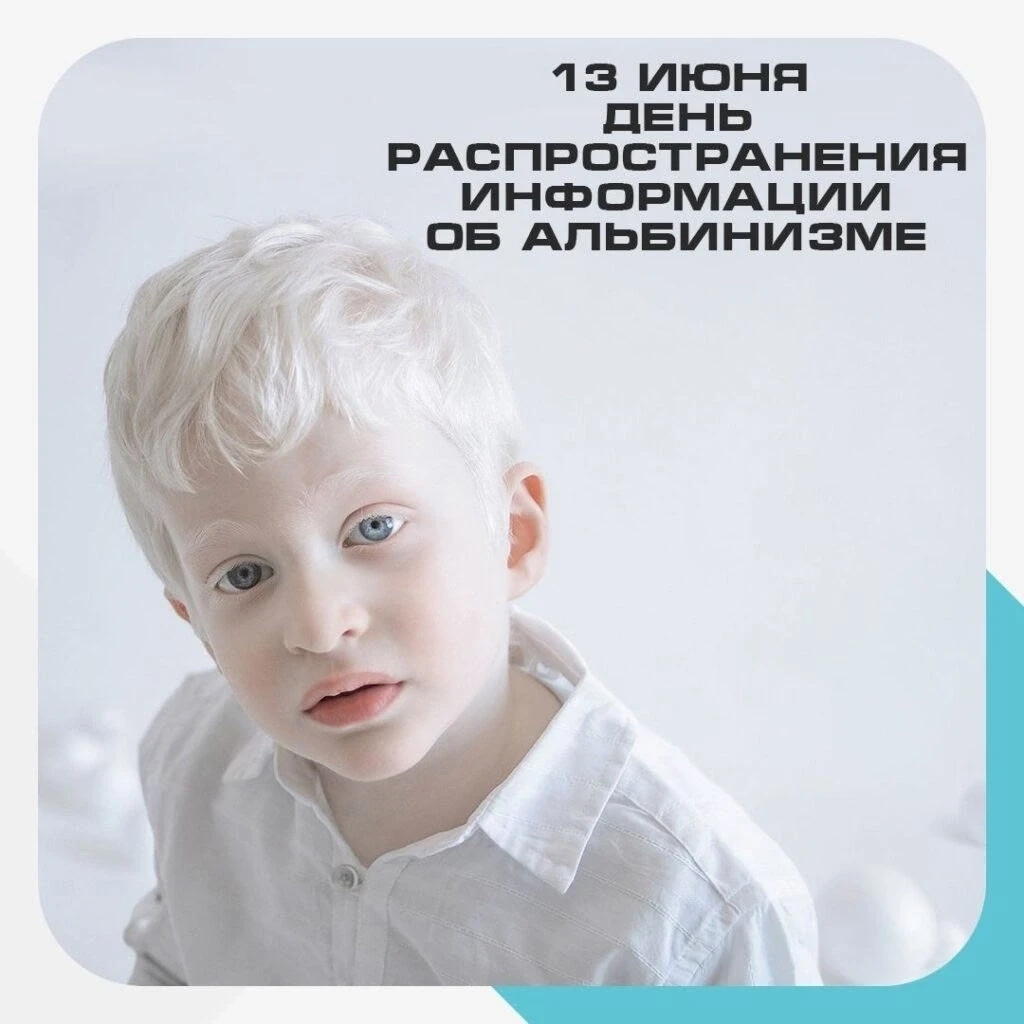 🔥❗ Международный день распространения информации об альбинизме.❗🔥 

 Учреждён ООН в 2014 году. Нап