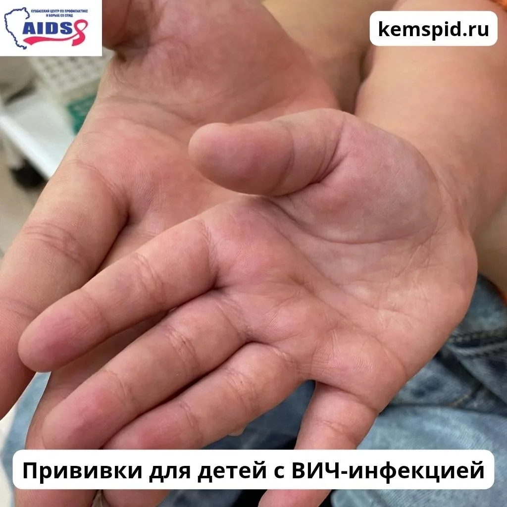 Прививки для детей с ВИЧ-инфекцией возможны и настоятельно рекомендуются