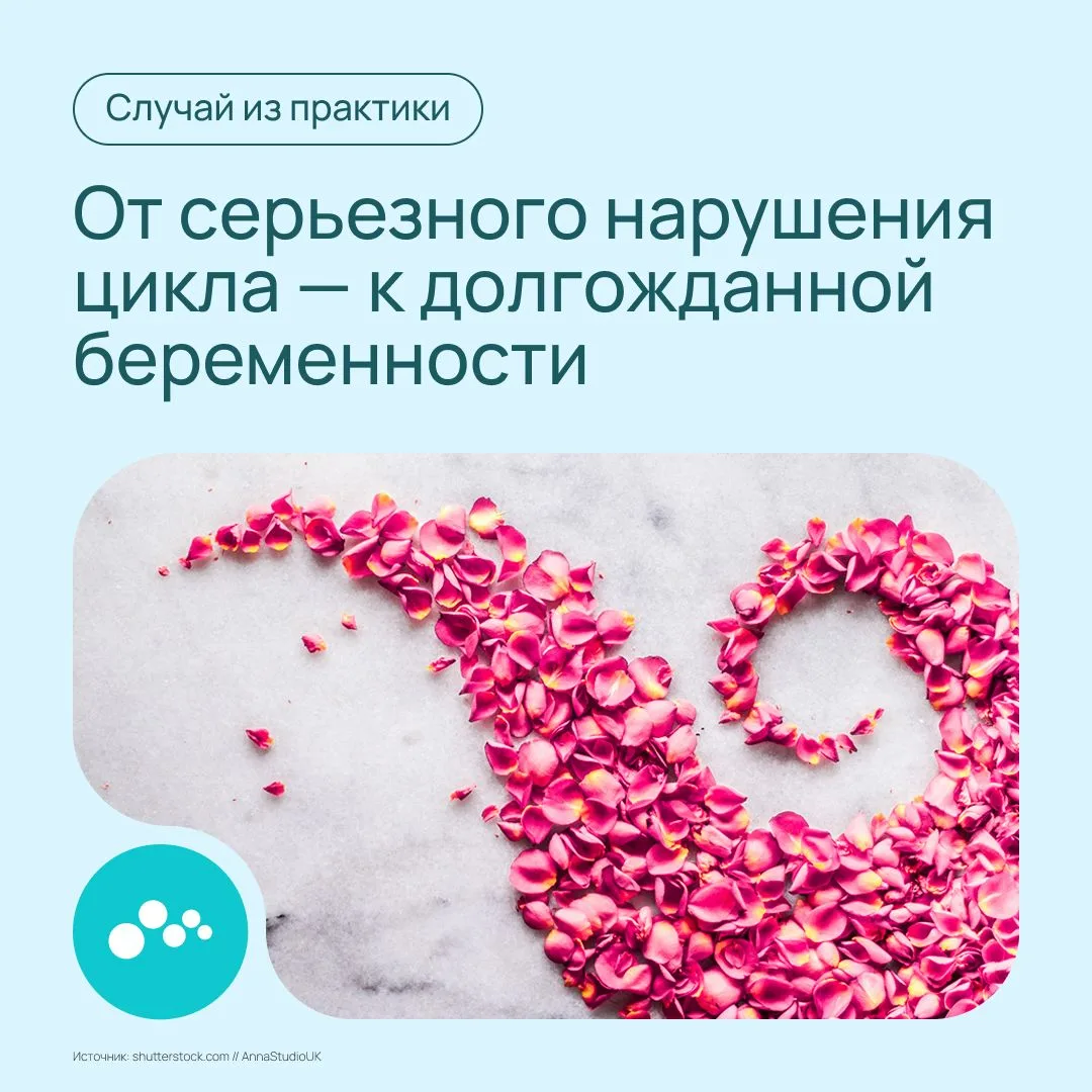 К Анне Викторовне Свистуновой, врачу высшей квалификационной категории, акушеру-гинекологу ММЦ МЕДСИ