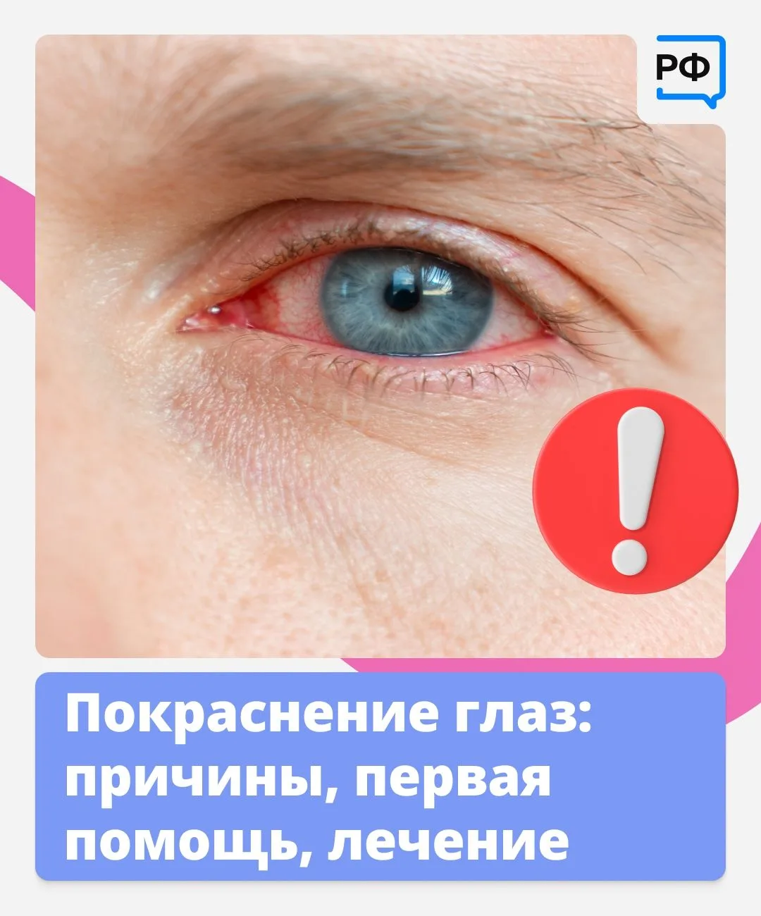 Красные глаза — это красный флаг! Они прямо сигнализируют: пора обратить на них внимание.